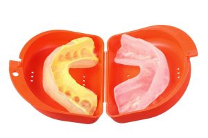 an image of a dental mouthguard