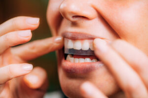 How to Whiten Your Teeth at Home Safely and Effectively