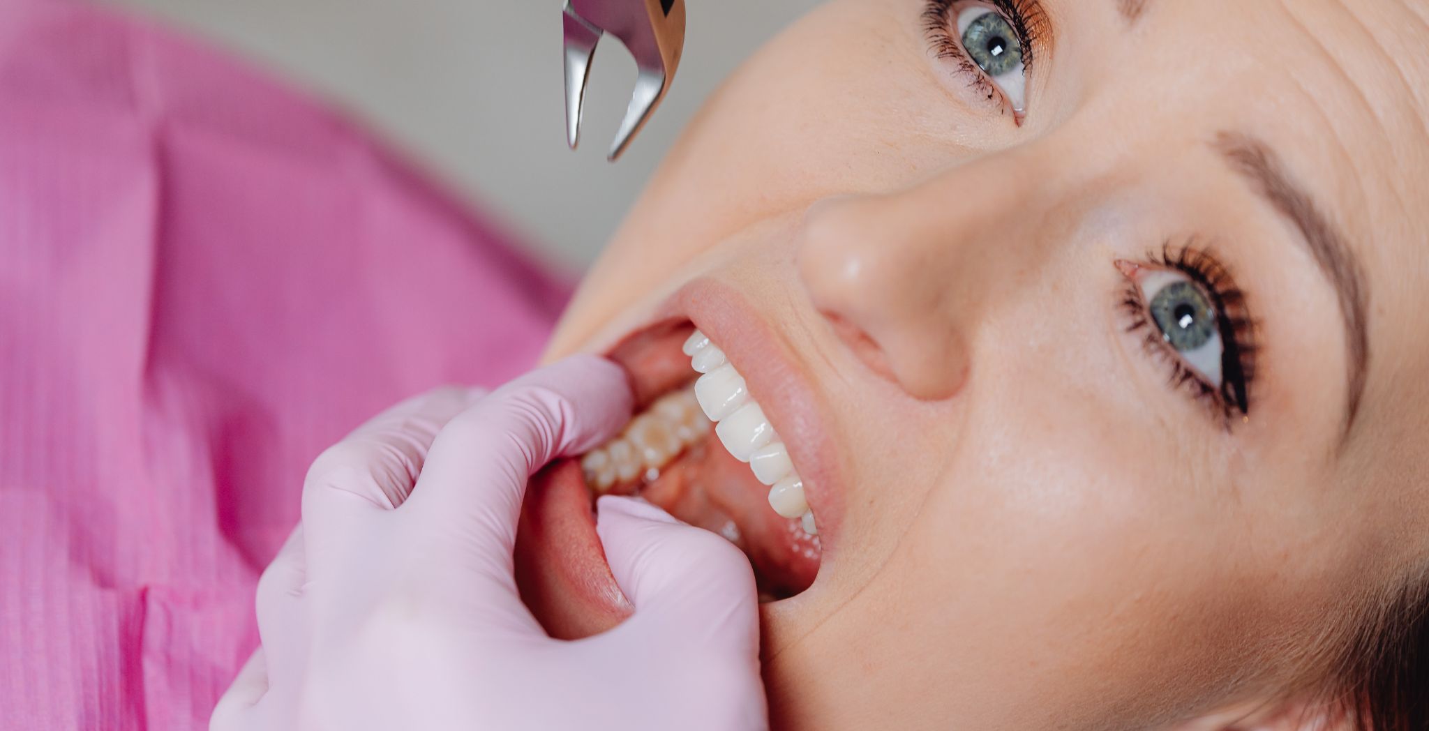 Dry Socket Dangerous, Dry socket complications, Risks of dry socket, Dry socket symptoms